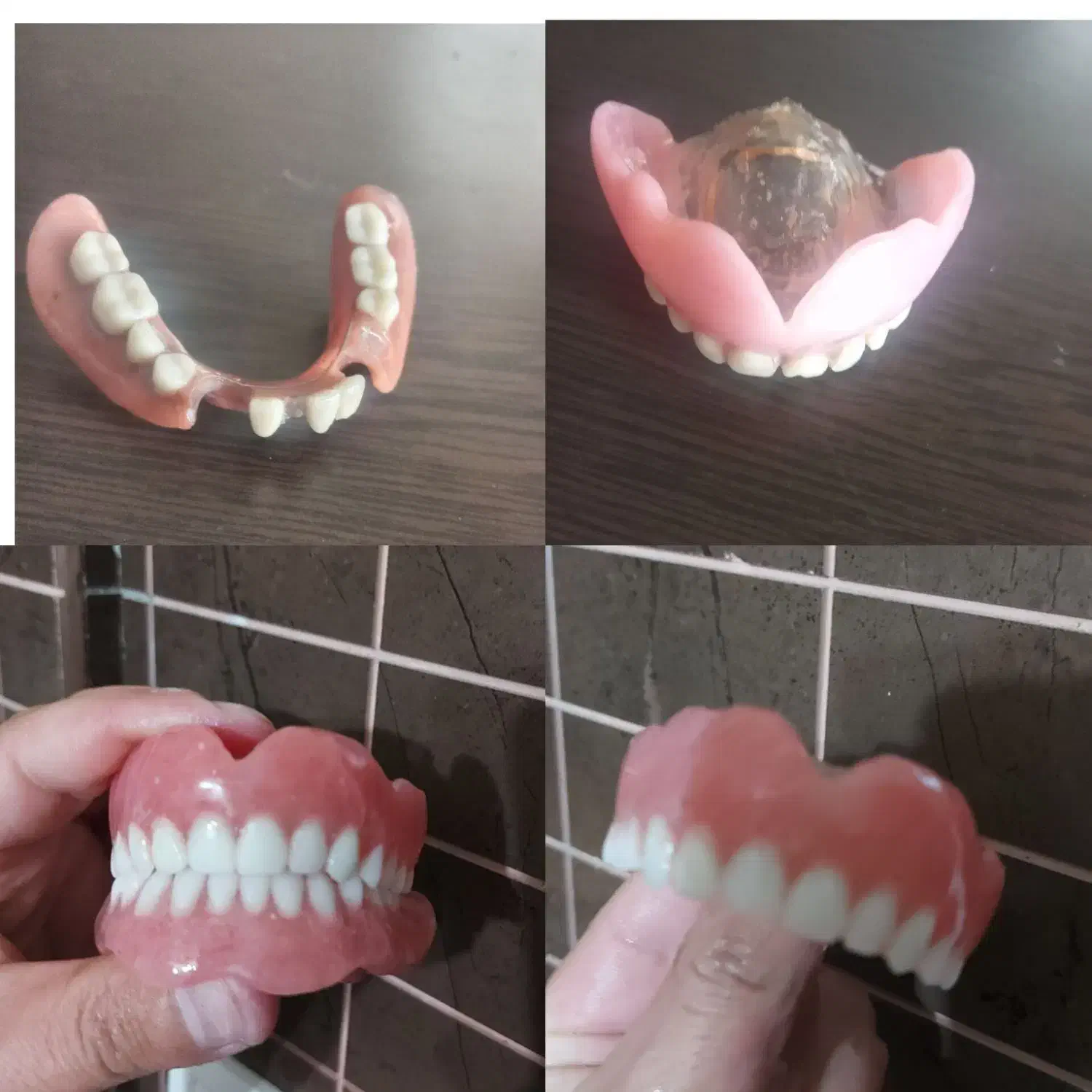 چی بود و چی شد دندان مصنوعی|فعالیت داوطلبانه|ایجرود, |دیوار