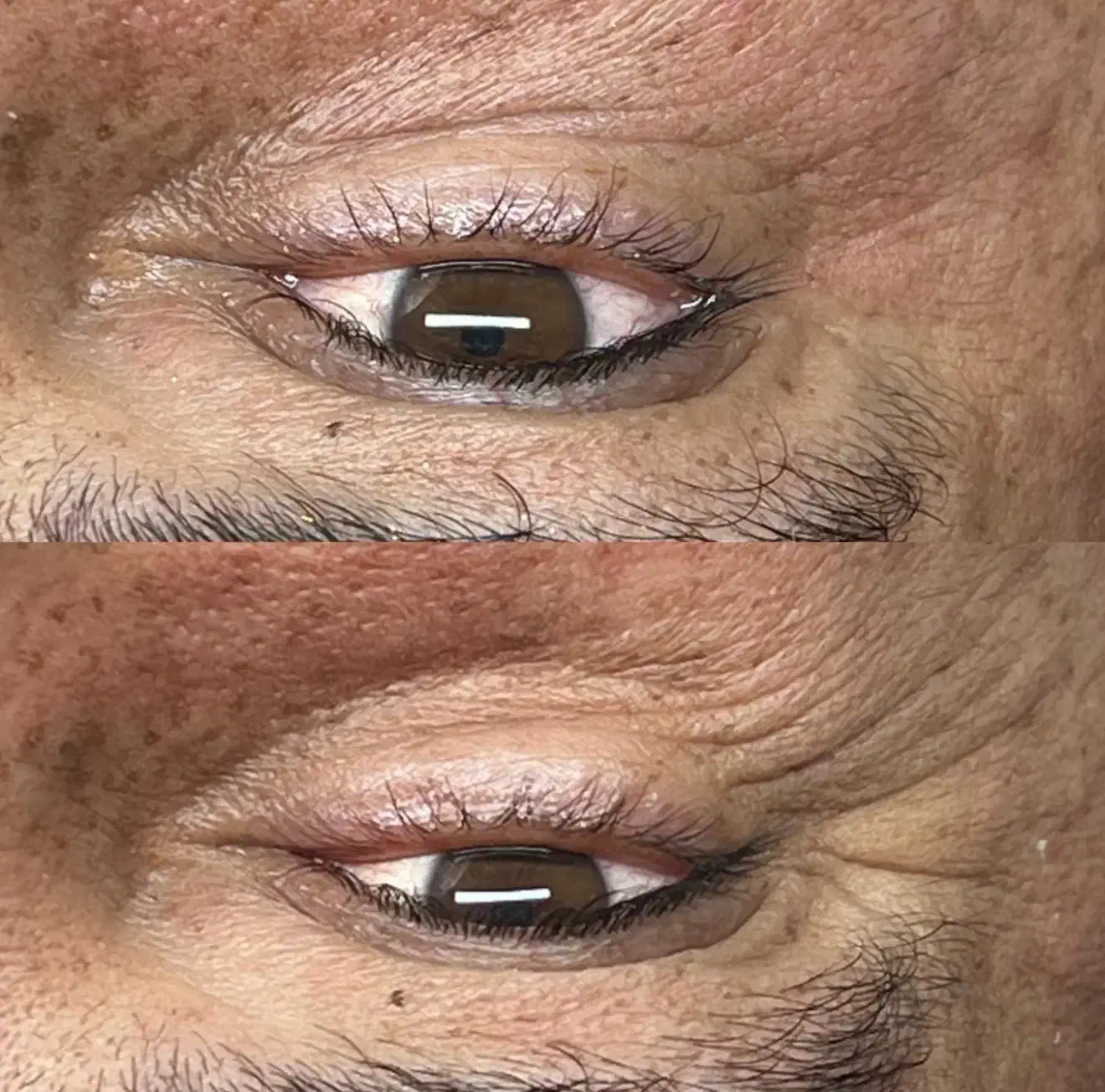 پاکسازی۱۴مرحله اقاوخانم کلینیک پزشک روشنی تضمینی|خدمات آرایشگری و زیبایی|بیرجند, |دیوار