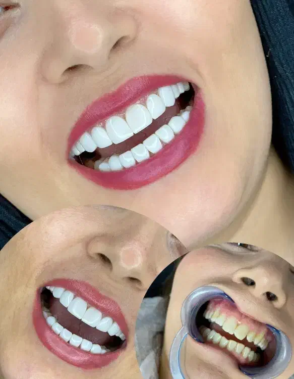 کامپوزیت 20تومنی|خدمات آرایشگری و زیبایی|بروجرد, |دیوار