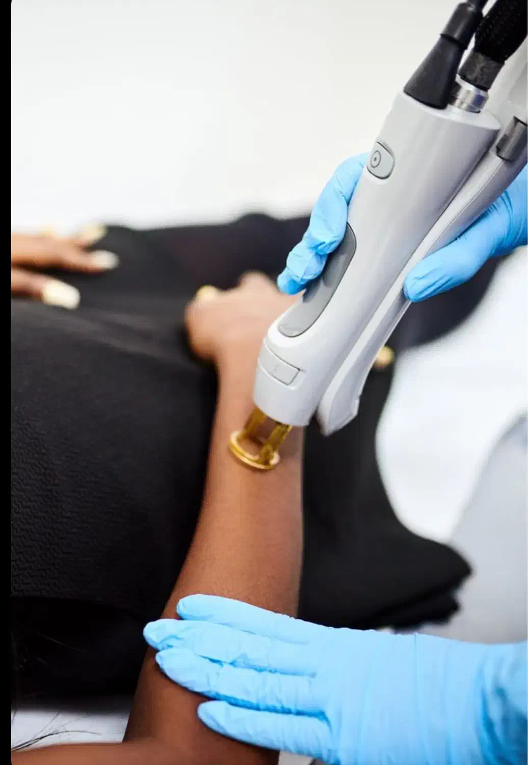 همکار لیزرکار مجهز به دستگاه لیزر|استخدام درمانی، زیبایی، بهداشتی|اردبیل, |دیوار