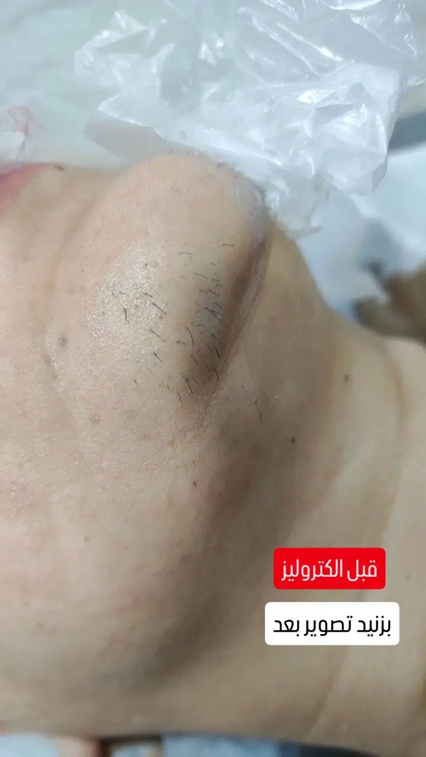 نیازمند دکتر عمومی|استخدام درمانی، زیبایی، بهداشتی|سقز, |دیوار