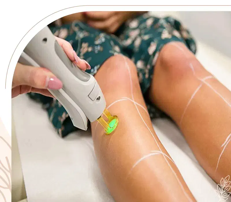 دستگاه لیزر شاتی کندلا2025|خدمات آرایشگری و زیبایی|بروجرد, |دیوار