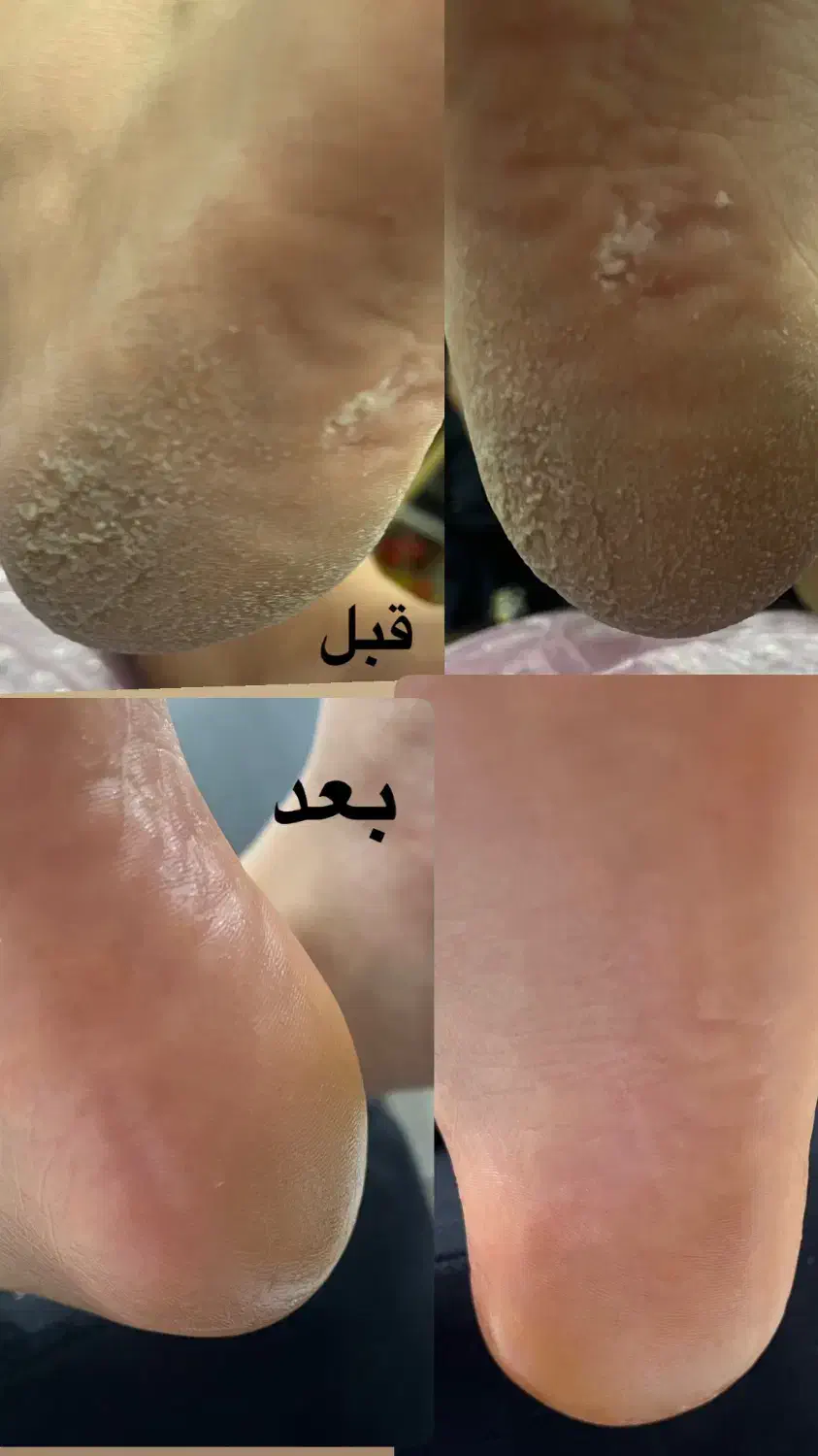 پدیکور پا (اموزش پدیکور) خدمات ناخن ، پاکسازی ، ا|خدمات آرایشگری و زیبایی|بوشهر, |دیوار