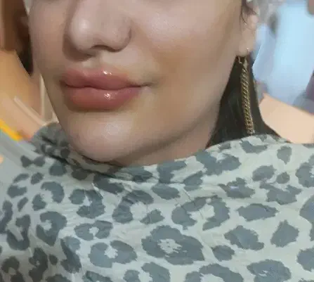 ژل بوتاکس فقط ۷۰۰|خدمات آرایشگری و زیبایی|مشهد, فرهنگ|دیوار