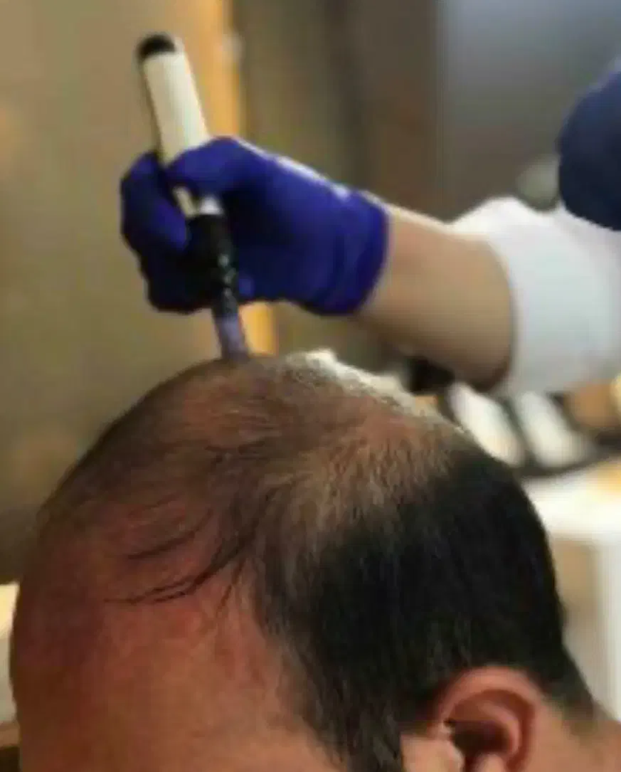 مزوتراپی مو|خدمات آرایشگری و زیبایی|تهران, بلوار کشاورز|دیوار