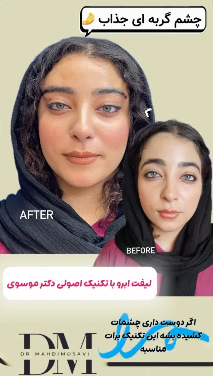 مرکز تخصصی تزریق فول فیس چربی و فیلر/لیفت با نخ|خدمات آرایشگری و زیبایی|مشهد, هنرستان|دیوار