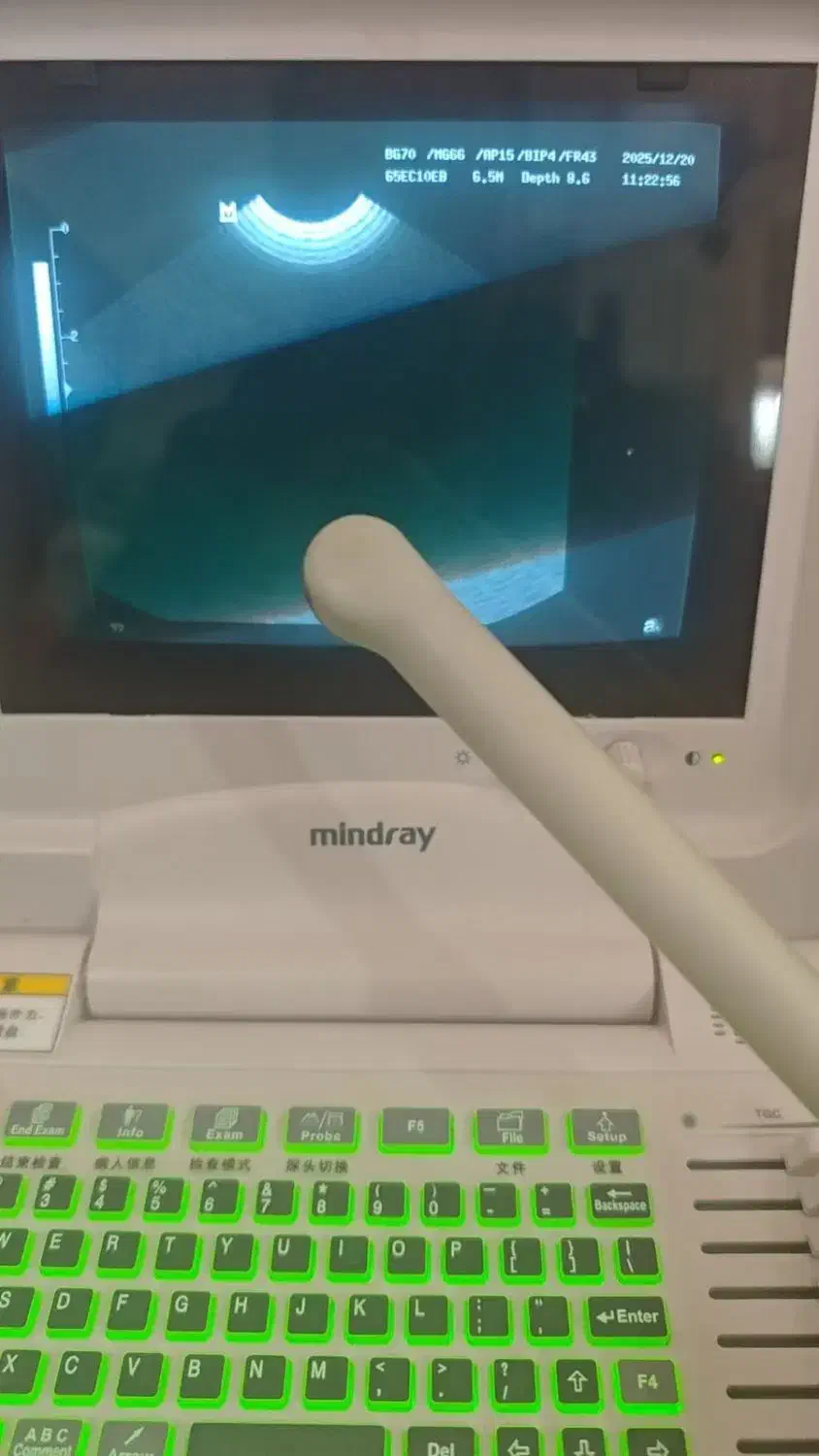 واردات فروش و تعمیرات دستگاه های سونوگرافی|پزشکی|شیراز, آزادی|دیوار