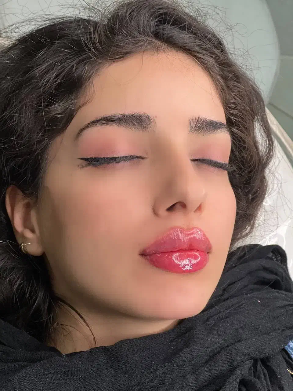 تزریق ژل وبوتاکس|خدمات آرایشگری و زیبایی|جوانرود, |دیوار