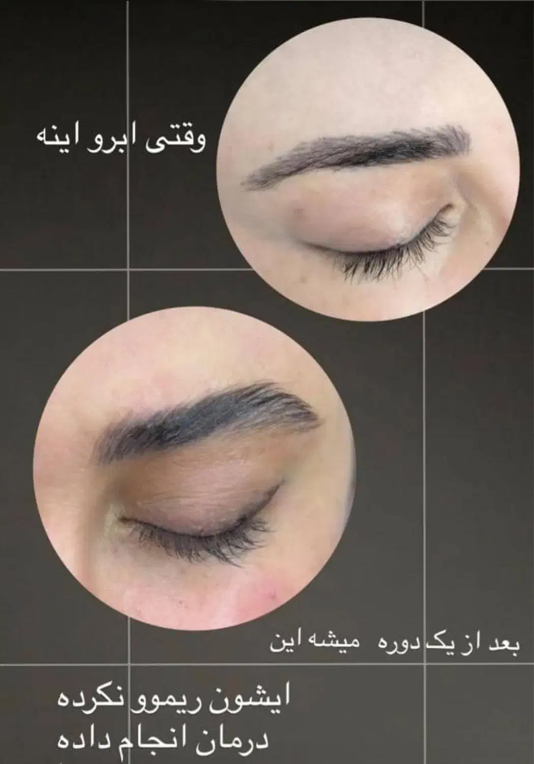 خداحافظی با ریزش مو و ابرو|خدمات آرایشگری و زیبایی|شیراز, قصرالدشت|دیوار