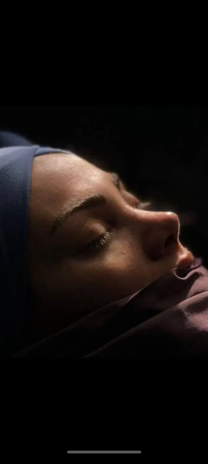 جنشواره عمل بینی|خدمات آرایشگری و زیبایی|حمیدیه, |دیوار