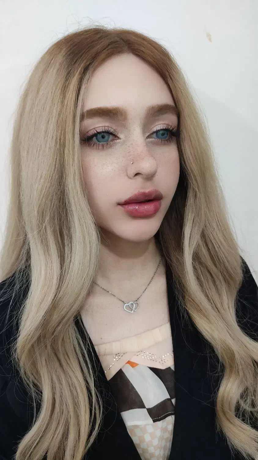 تزریقات تخصصی فیلر و بوتاکس|خدمات آرایشگری و زیبایی|مسجد سلیمان, |دیوار