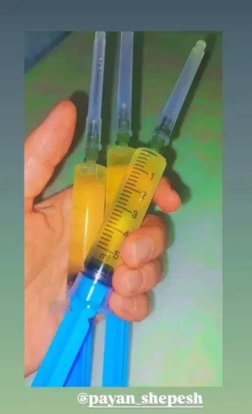 یه تیر درتاریکی عزیزان|آرایشی، بهداشتی، درمانی|آزادشهر, |دیوار