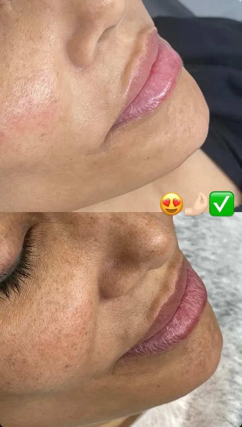 درمان مشکلات پوستی|خدمات آرایشگری و زیبایی|شاهین دژ, |دیوار