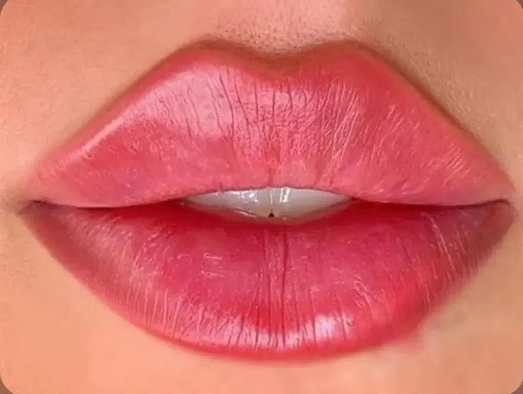 آموزش پزشک بوتاکس نخ مزو ژل لیفت prp لیزرآنزیم مطب|خدمات آموزشی|کرج, گوهردشت|دیوار