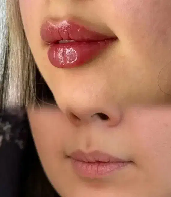 ژل لب، فیلر صورت، بوتاکس|خدمات آرایشگری و زیبایی|نجفآباد, امام خمینی|دیوار