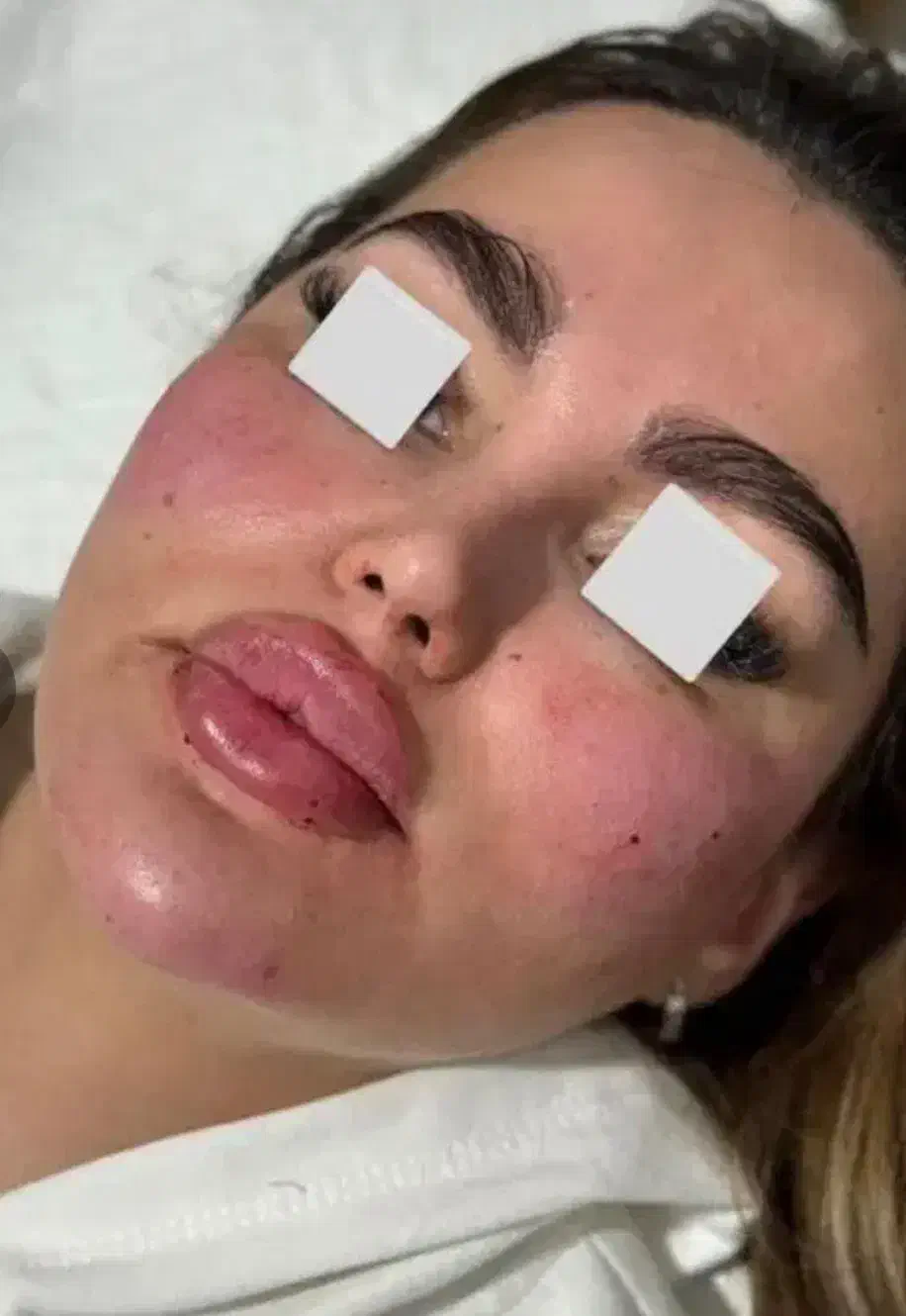 خدمات تزریق چربی ، ژل، بوتاکس، فیلر بادی|خدمات آرایشگری و زیبایی|قم, پردیسان|دیوار