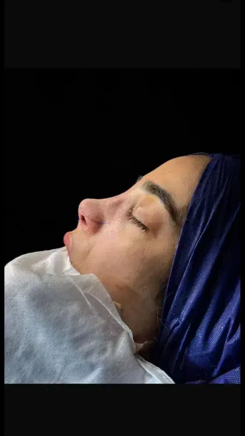 جشنواره عمل بینی|خدمات آرایشگری و زیبایی|ری, علایین|دیوار