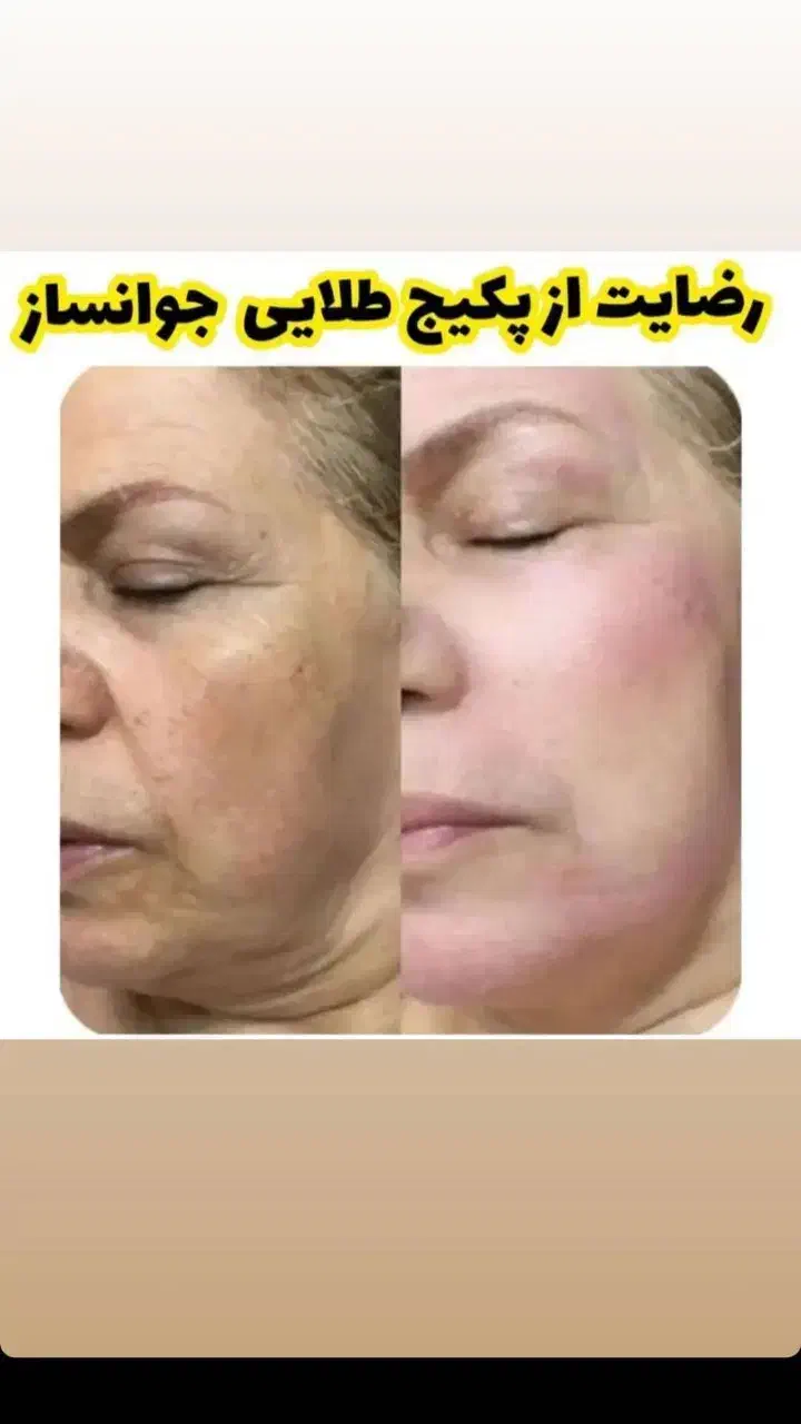 لامچری|آرایشی، بهداشتی، درمانی|همدان, |دیوار