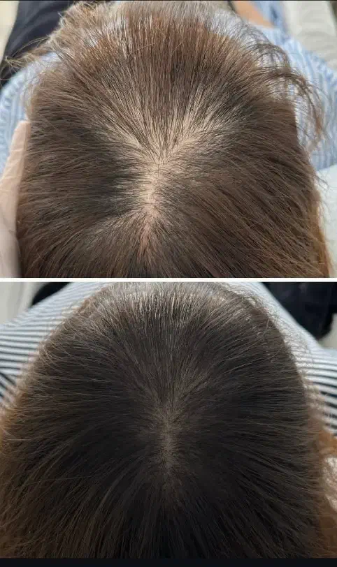 میکرواسکالپ تخصصی با جدیدترین متدvip|خدمات آرایشگری و زیبایی|مشهد, گوهرشاد|دیوار