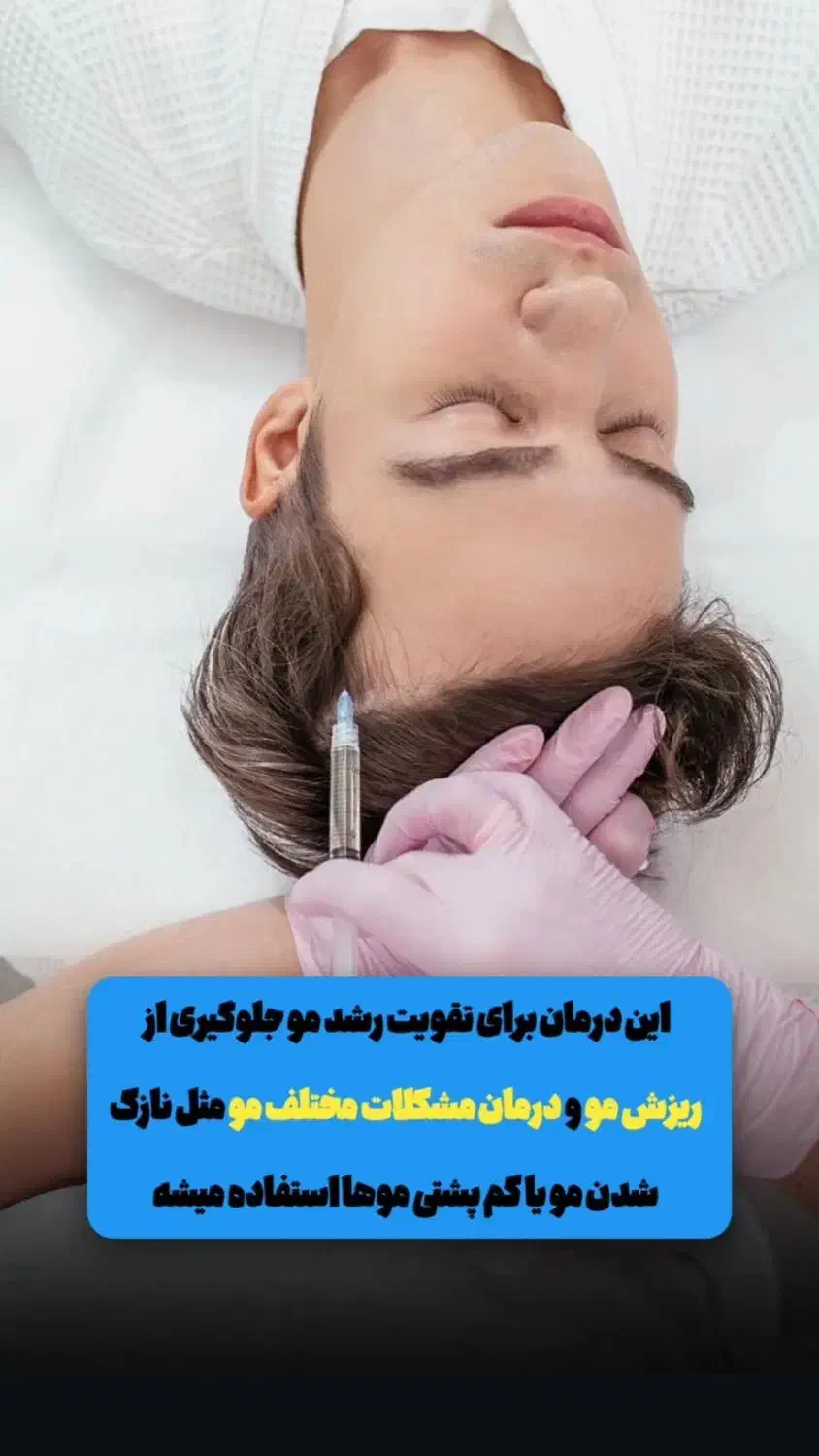 پی آر پی و مزوتراپی با بالاترین کیفیت|خدمات آرایشگری و زیبایی|اهواز, زیتون کارمندی|دیوار