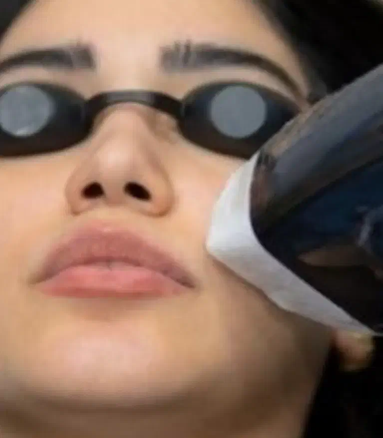 استخدام اپراتور لیزر دستگاه تیتانیوم|استخدام درمانی، زیبایی، بهداشتی|تهران, بهداشت|دیوار