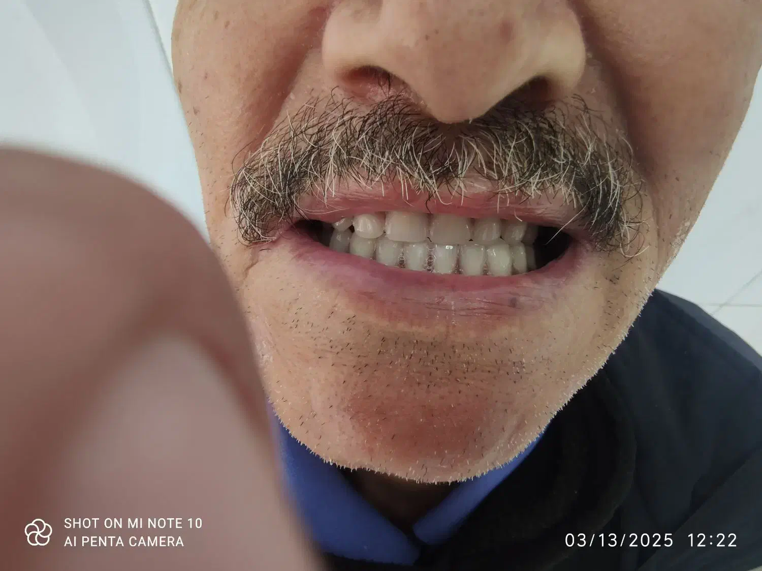 ساخت انواع دندان های مصنوعی متحرک و لثه ژله ای|آرایشی، بهداشتی، درمانی|شیراز, اصلاحنژاد|دیوار