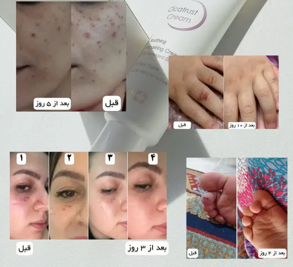 پوستتو با ما ترمیم کن|آرایشی، بهداشتی، درمانی|شیراز, ستارخان|دیوار