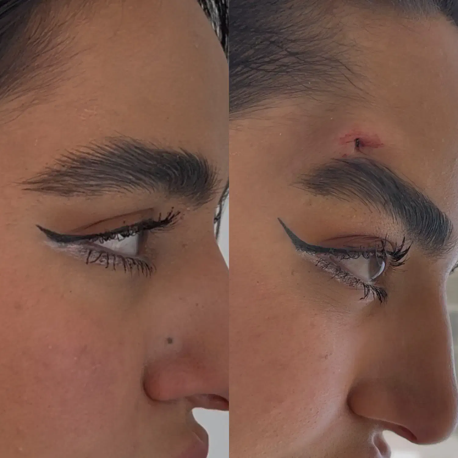 تزریق ژل و بوتاکس و مادلینگ عربی|خدمات آرایشگری و زیبایی|کرمانشاه, |دیوار