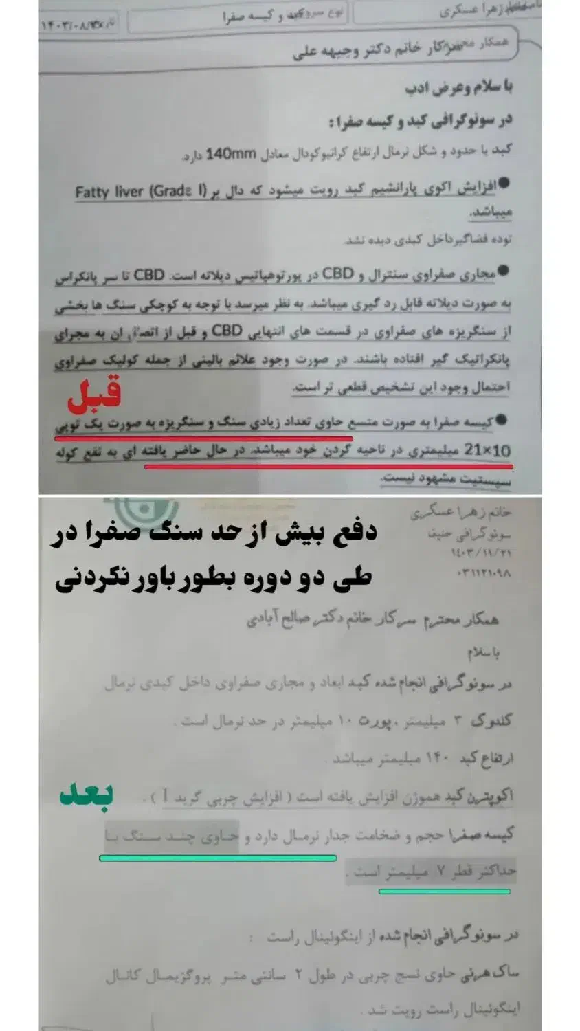 درمان سنگ کلیه|آرایشی، بهداشتی، درمانی|خاش, |دیوار