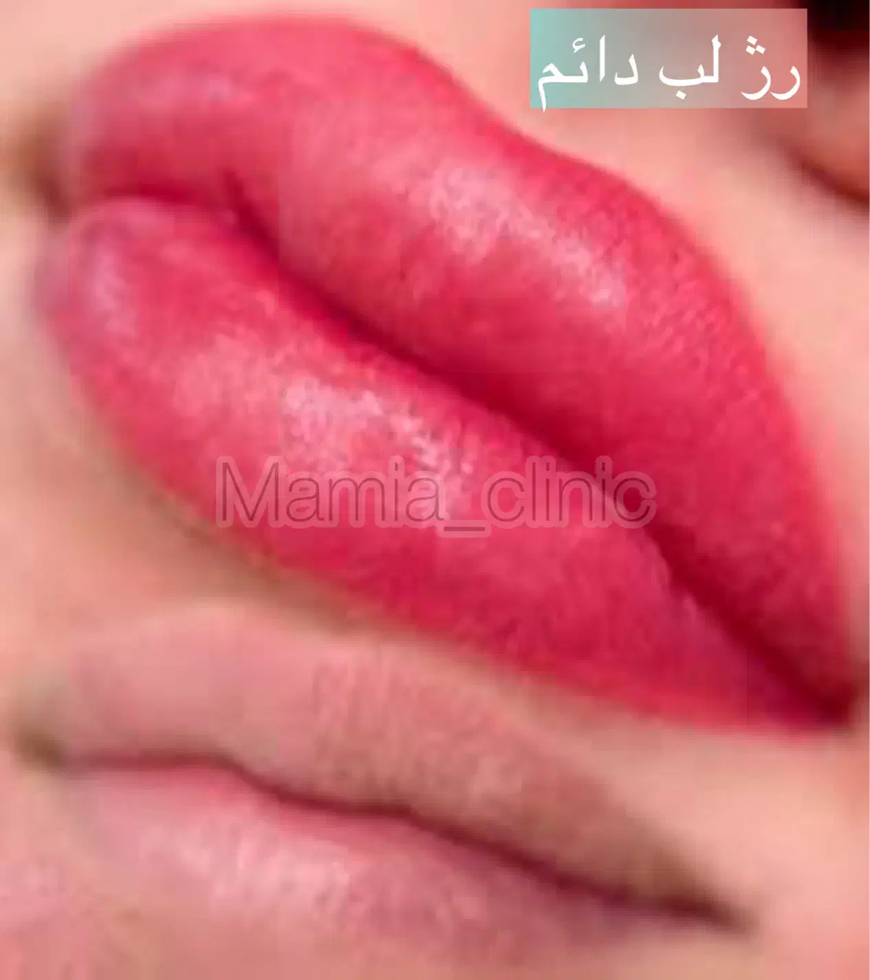 شید لب/رژلب/رفع لب تیره/مزووایت کرمپودر دایم|خدمات آرایشگری و زیبایی|اهواز, فرهنگ شهر|دیوار
