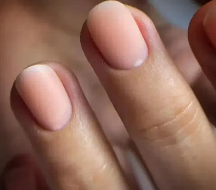 کاشت ۴۸۰ ترمیم ۳۰۰|خدمات آرایشگری و زیبایی|رفسنجان, |دیوار