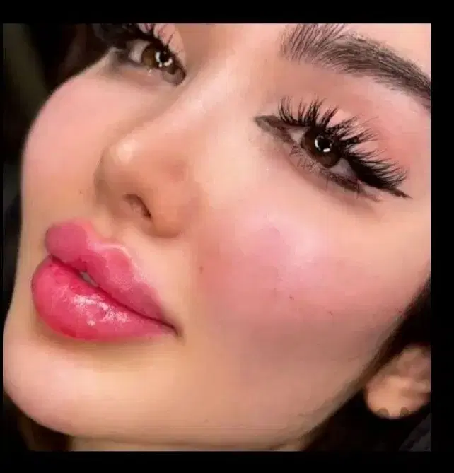تزریق ژل|خدمات آرایشگری و زیبایی|بندر گناوه, |دیوار