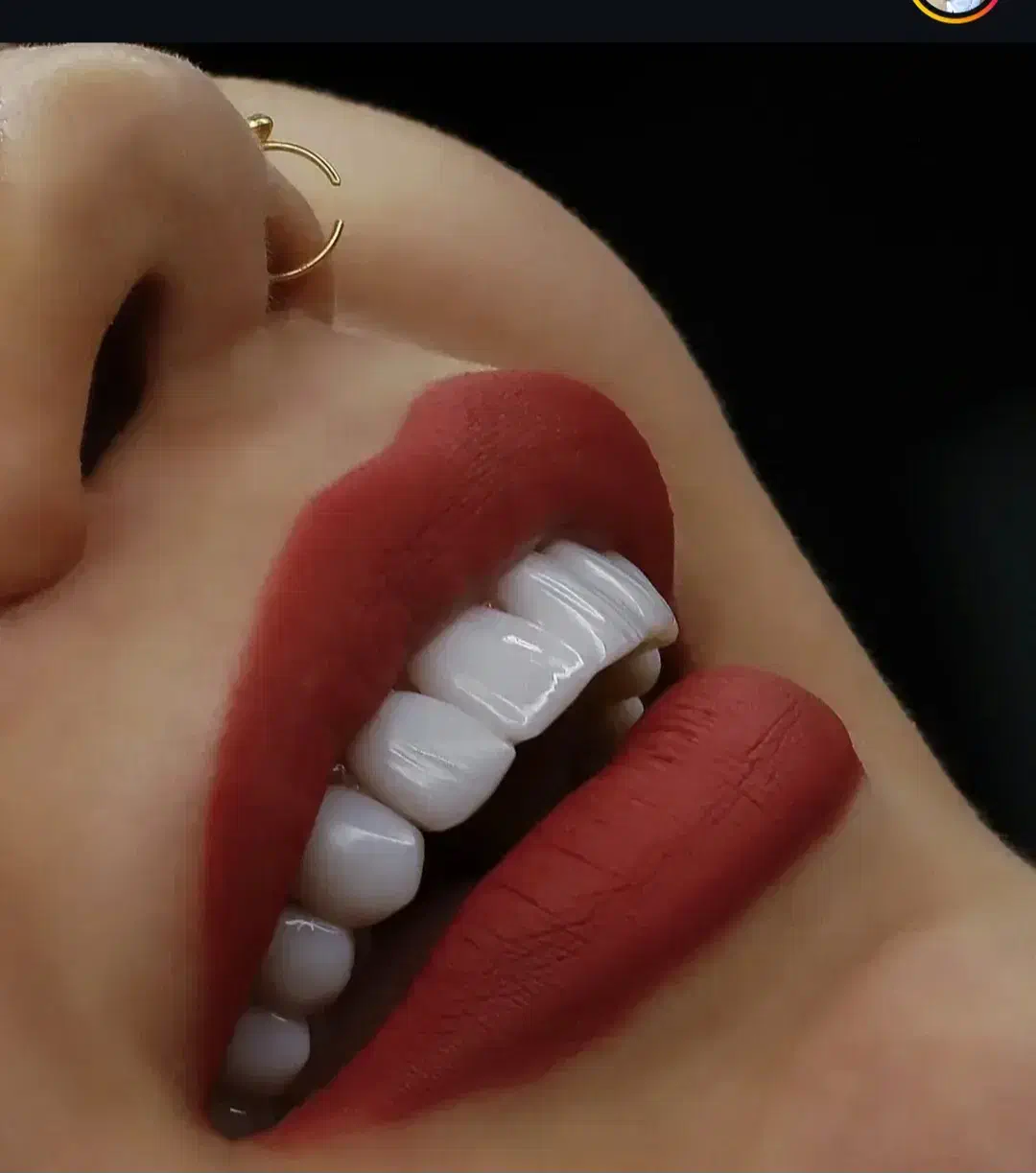 کامپوزیت دندان|خدمات آرایشگری و زیبایی|پرند, فاز ۶|دیوار