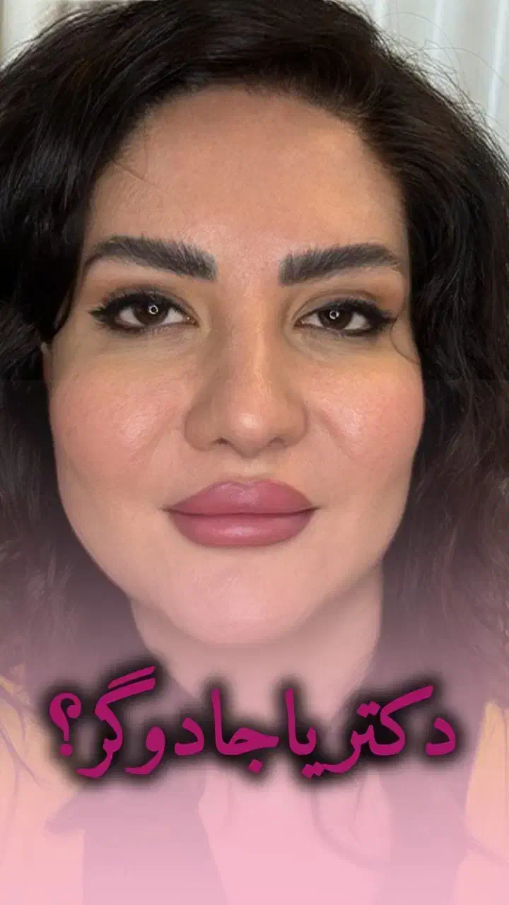 آموزش تخصصی و درمانی ژل و بوتاکس|خدمات آموزشی|اصفهان, مهدی آباد|دیوار