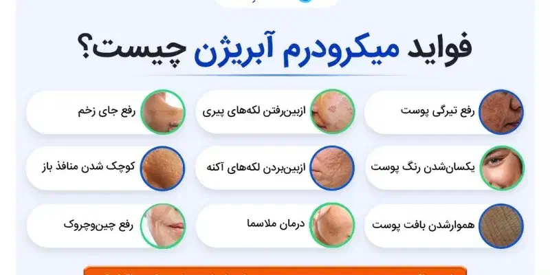 فیشیال تخصصی پوست بادستگاه میکرودرم،150 تا یلدا|خدمات آرایشگری و زیبایی|سبزوار, قاضی زاد|دیوار