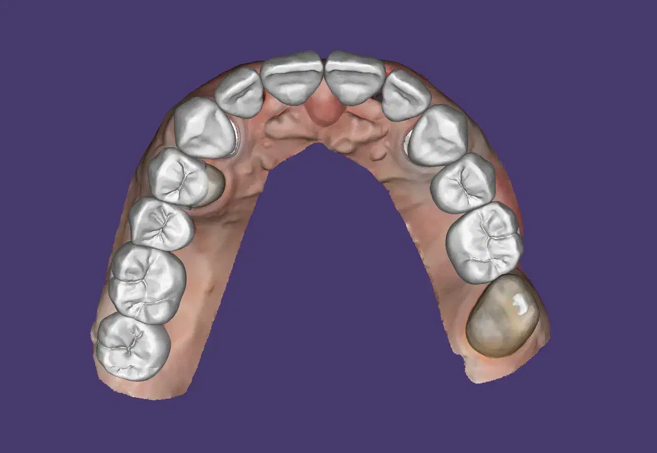 جذب نیروی کار خانم در لابراتوار دندانسازی|استخدام درمانی، زیبایی، بهداشتی|ساری, |دیوار