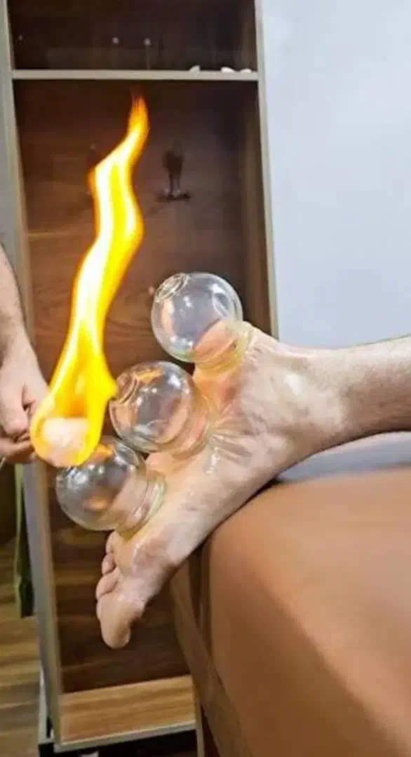 خدمات حجامت..زالو درمانی بادکش تسکین درد تضمینی|خدمات آرایشگری و زیبایی|اصفهان, باغ فدک|دیوار