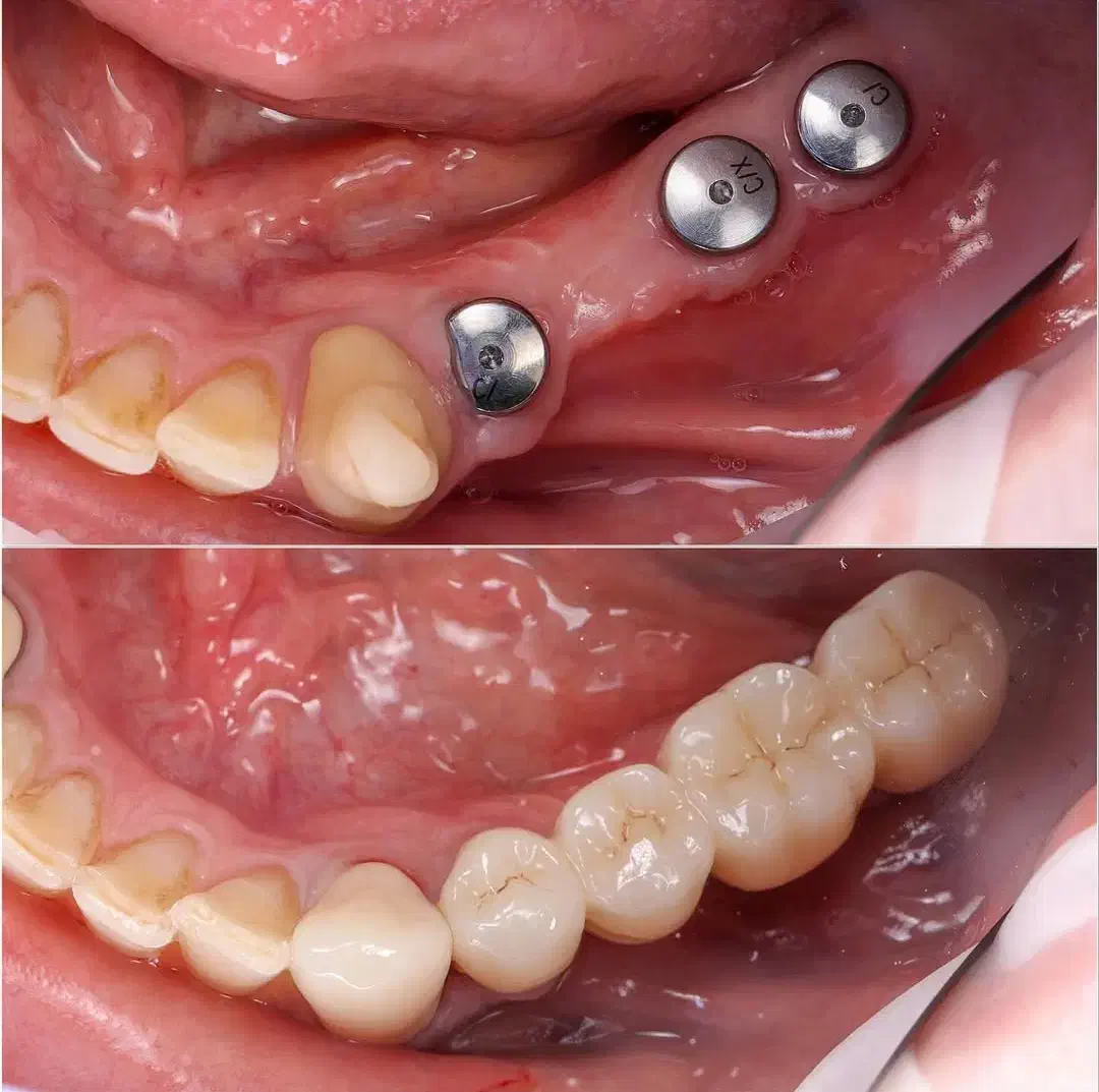 جراح دندانپزشک دکتر دانیال قشقایی|خدمات آرایشگری و زیبایی|کرمانشاه, |دیوار