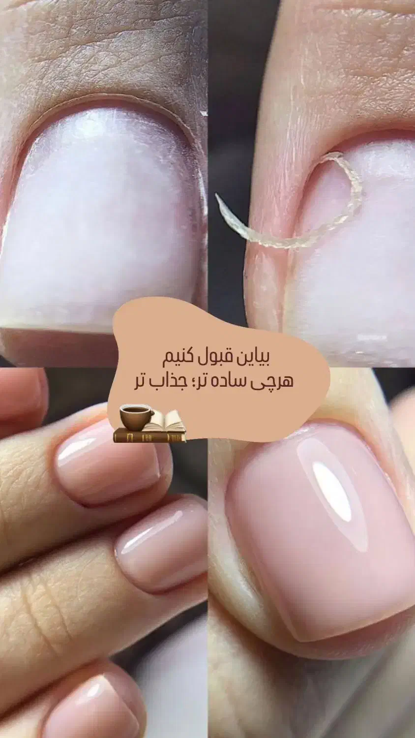 کاشت ناخن پیروزی جمهوری لمینت ژلیش ریمو ترمیم|خدمات آرایشگری و زیبایی|گلبهار, شهر جدید گلبهار|دیوار