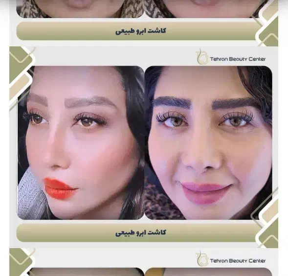 تور جراحی و خدمات زیبایی زیبایی|خدمات آرایشگری و زیبایی|کرمان, |دیوار