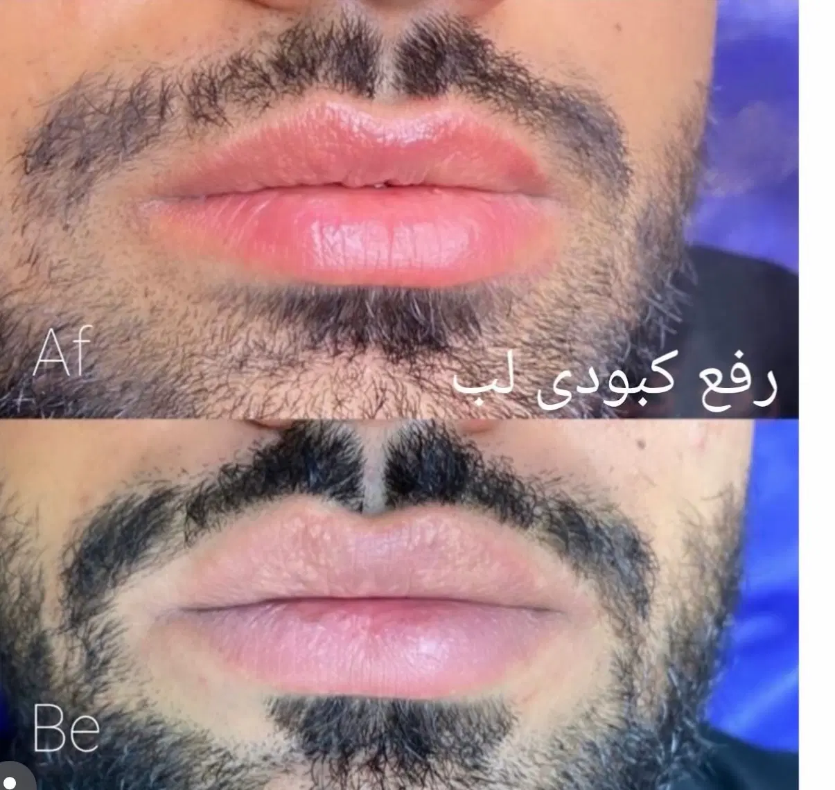 روشن سازی لب نچرال ، اسکالپ سر ، فیبروز ابرو نچرال|خدمات زیبایی و سلامت|شیراز, معالیآباد|دیوار