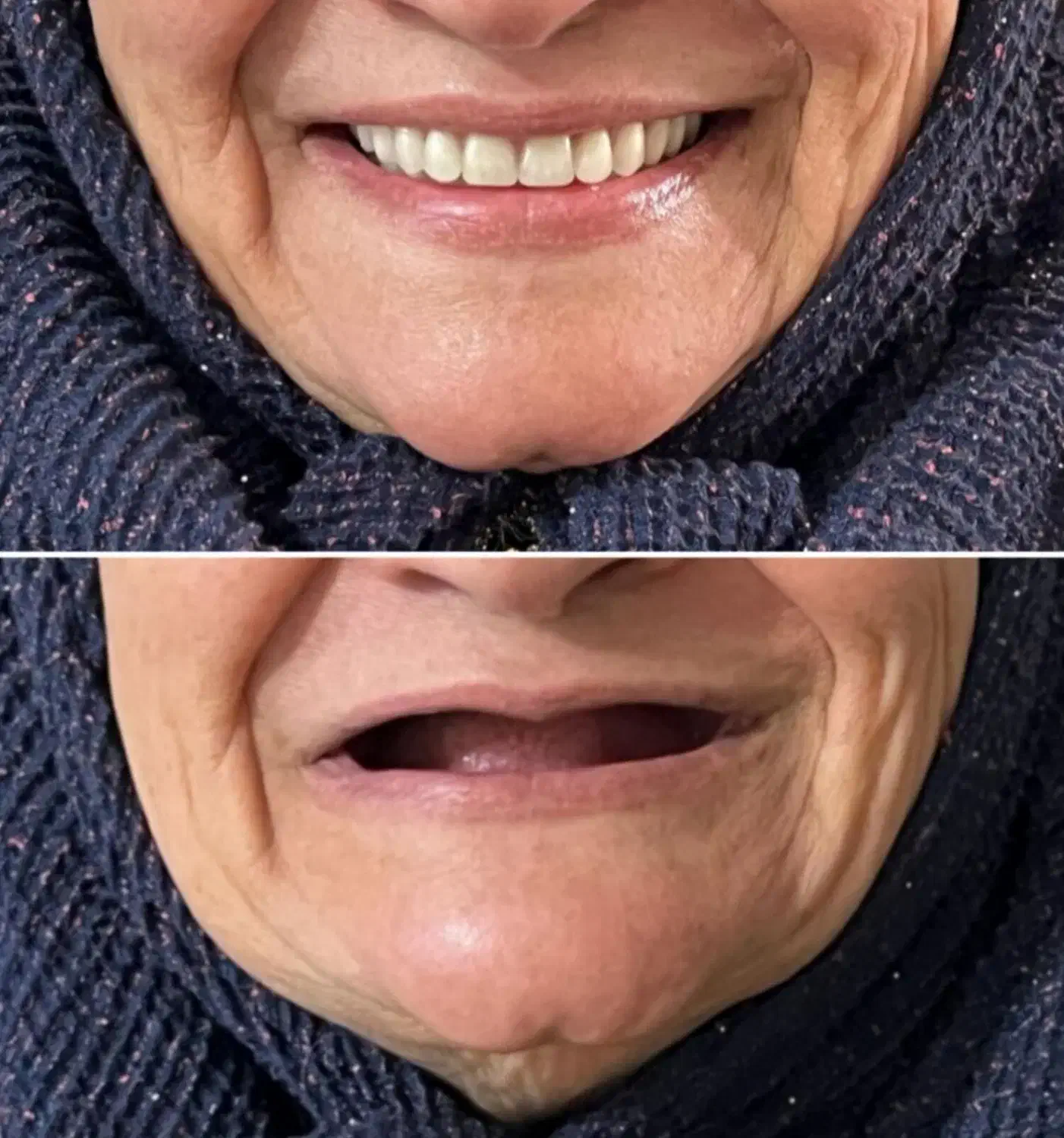 دندان مصنوعی و دندانسازی ، خدمات دندان سازی|خدمات آرایشگری و زیبایی|مشهد, شفا|دیوار