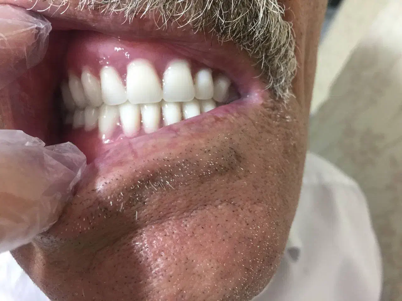 ساخت دندان مصنوعی|آرایشی، بهداشتی، درمانی|گلستان (تهران), |دیوار