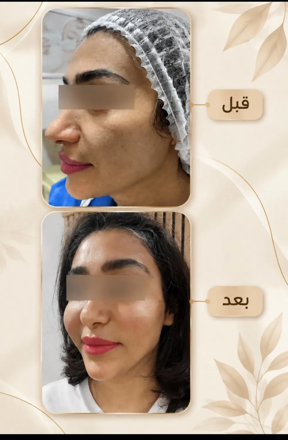 بهترین دکتر تزریق چربی تهران|خدمات زیبایی و سلامت|تهران, سعادتآباد|دیوار