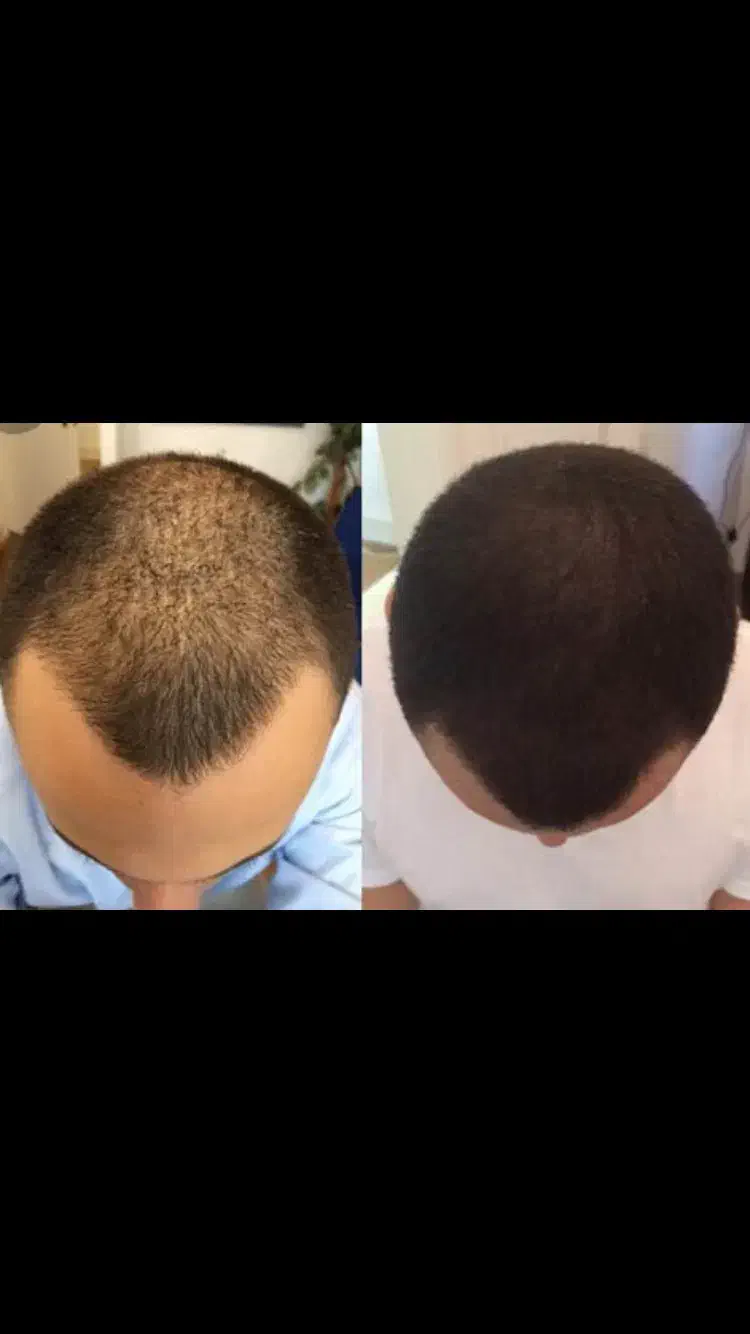 اسکالپ سر|خدمات آرایشگری و زیبایی|گرگان, |دیوار