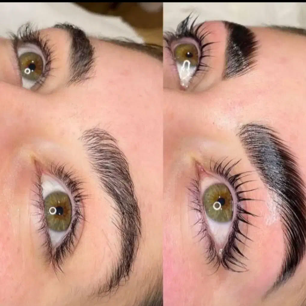 لیفت انجام بده و بوتاکس تراپی از من هدیه بگیر|خدمات آرایشگری و زیبایی|امیدیه, |دیوار