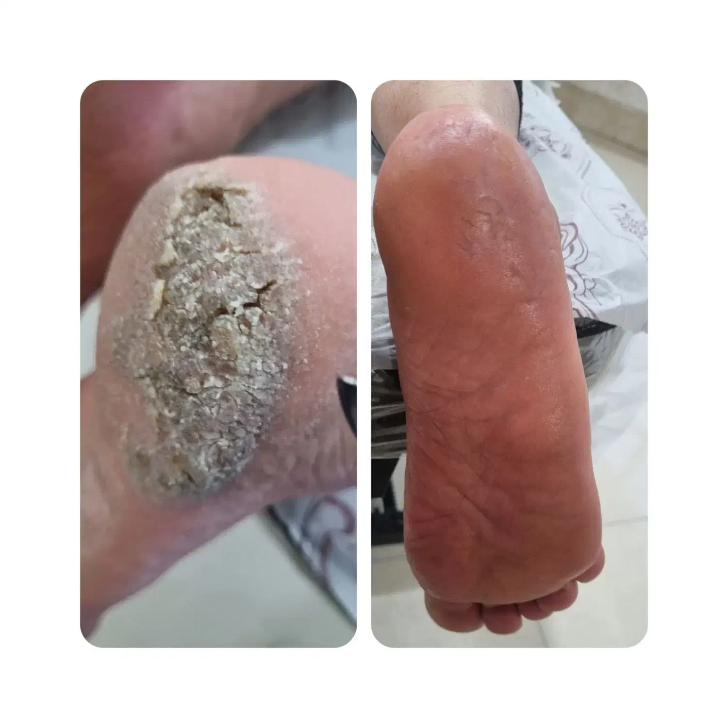 احیاو کراتین مو وپدیکور پا..از تخفیف ها جا نمونید|خدمات آرایشگری و زیبایی|شاهین‌شهر, فردوسی|دیوار