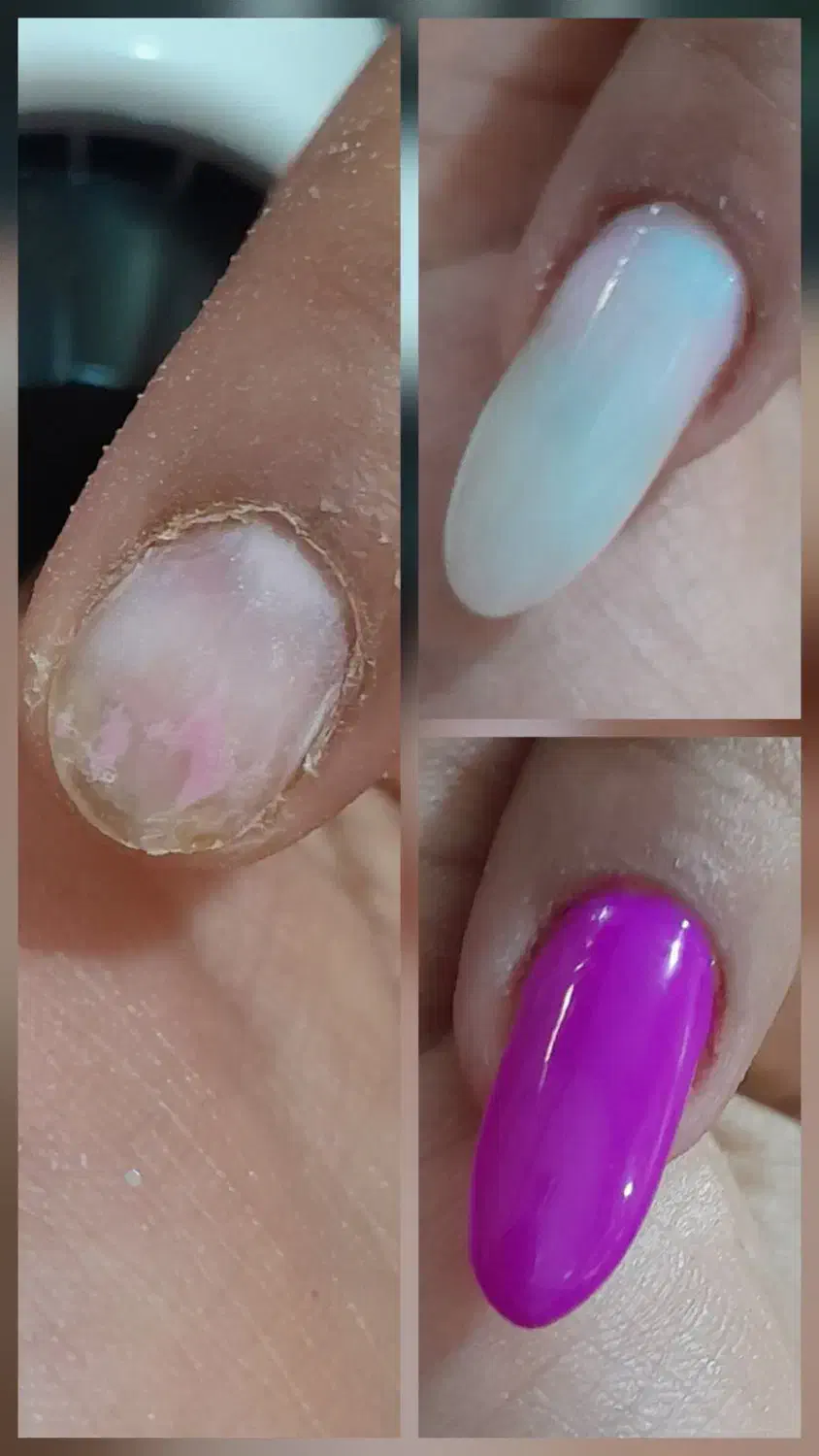 مدل کاشت ناخن|خدمات آرایشگری و زیبایی|اهواز, کوی رمضان|دیوار