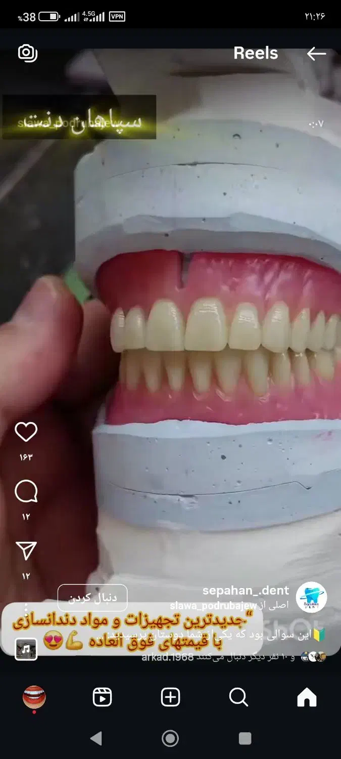 دندان مصنوعی المانی ضمانت ده سال|آرایشی، بهداشتی، درمانی|بوئین زهرا, |دیوار