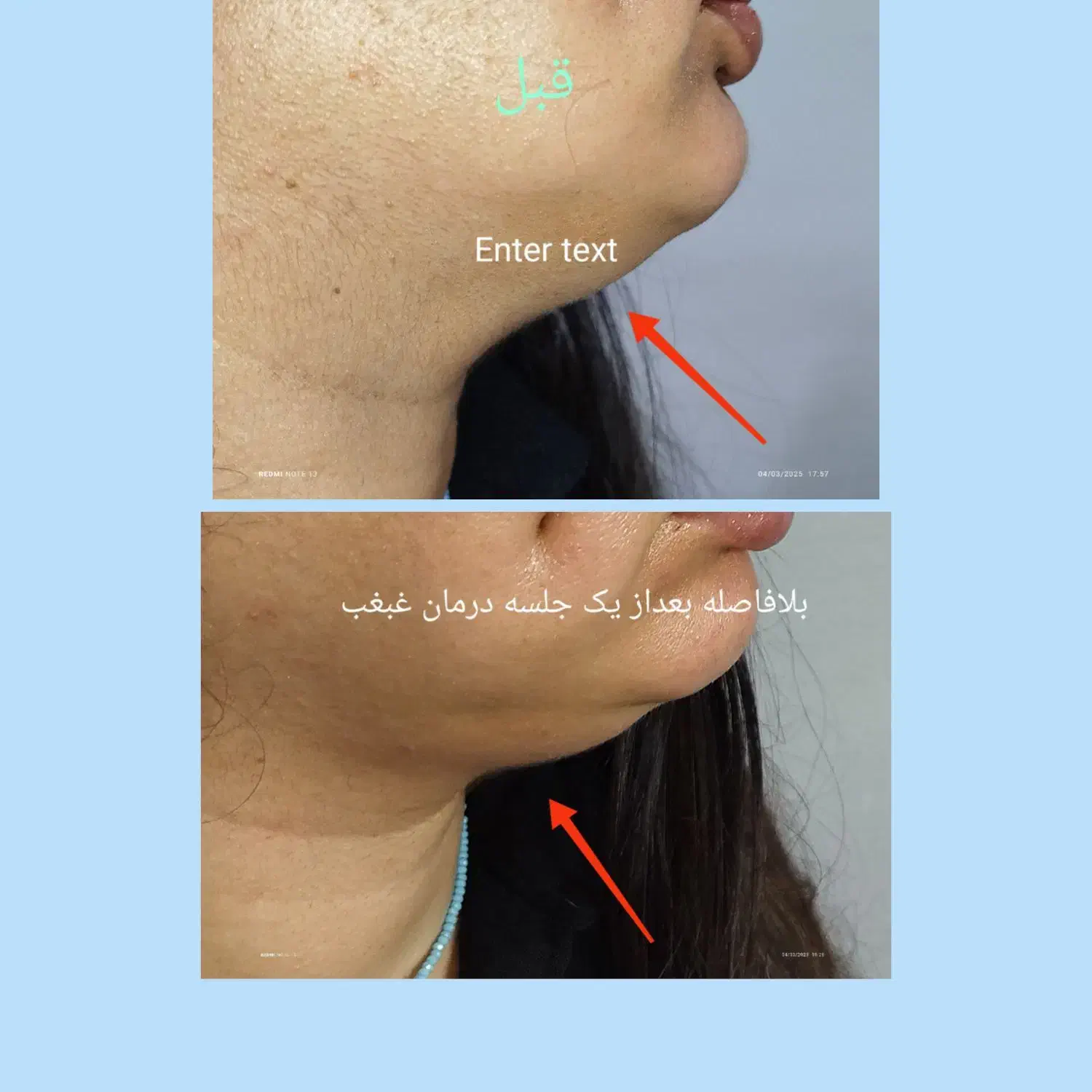 جوانسازی قوی بدون مواد|خدمات آرایشگری و زیبایی|رشت, کاکتوس|دیوار